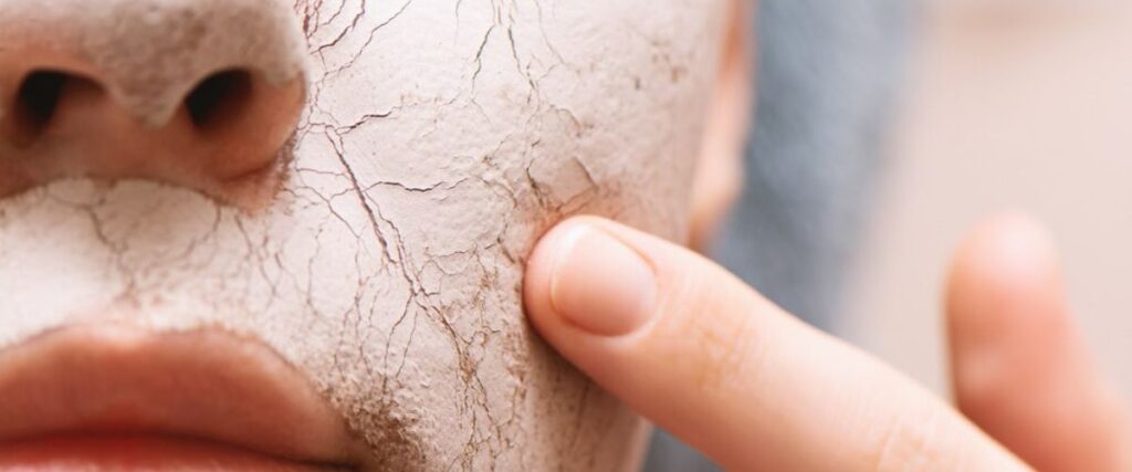 How To Remove Acne Scars From Buttocks Naturally